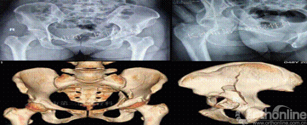 1.gif