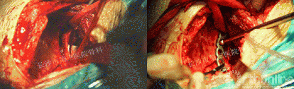 03.gif
