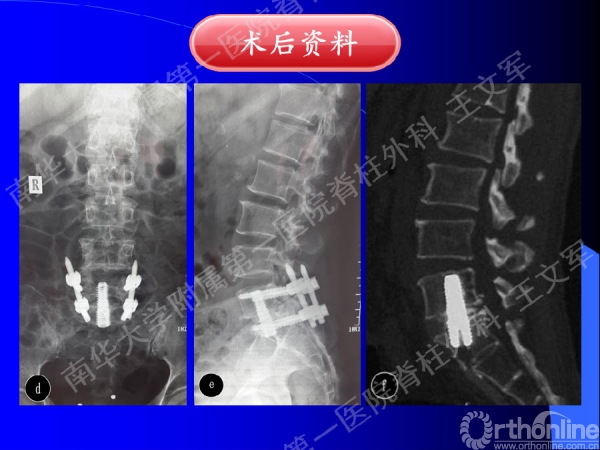 幻灯片28.PNG
