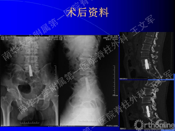 幻灯片33.PNG