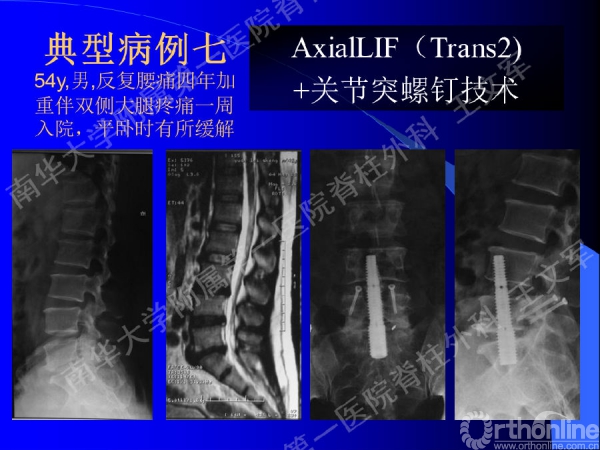 幻灯片35.PNG