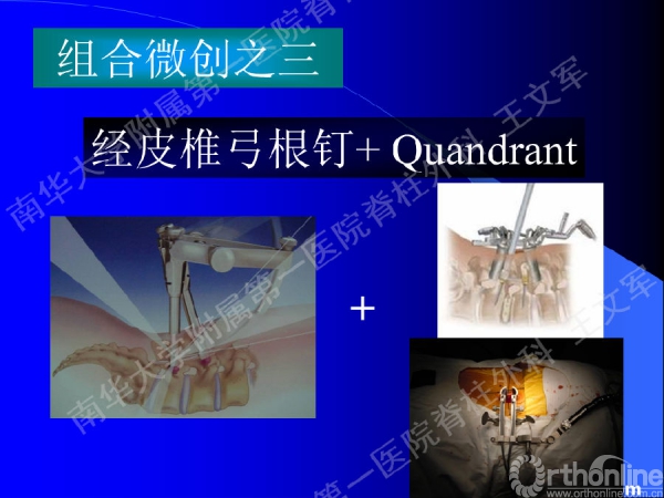 幻灯片43.PNG