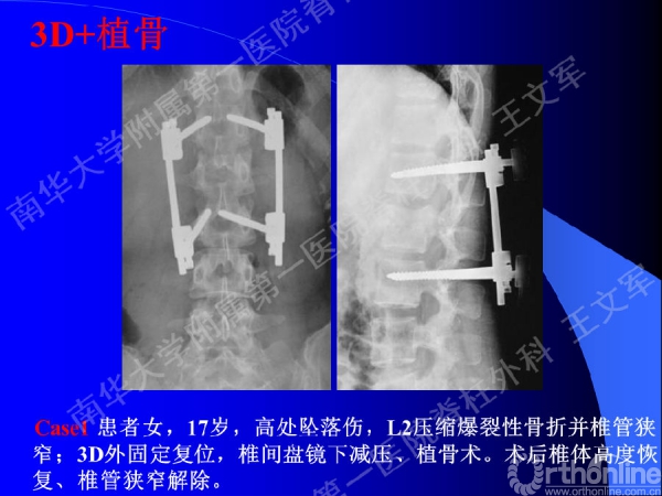幻灯片50.PNG