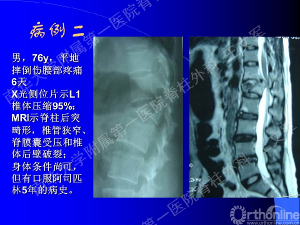幻灯片58.PNG