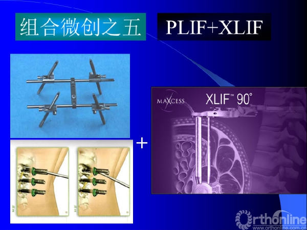 幻灯片61.PNG