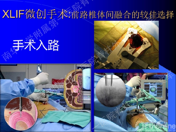 幻灯片62.PNG