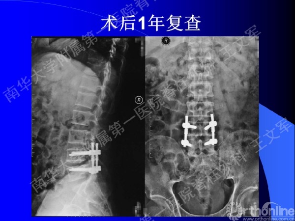 幻灯片79.PNG