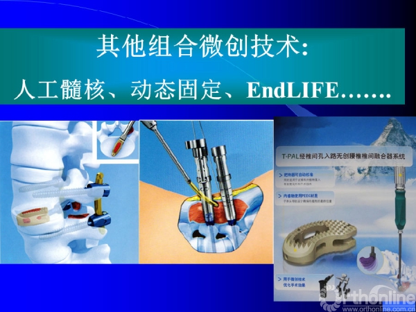 幻灯片81.PNG