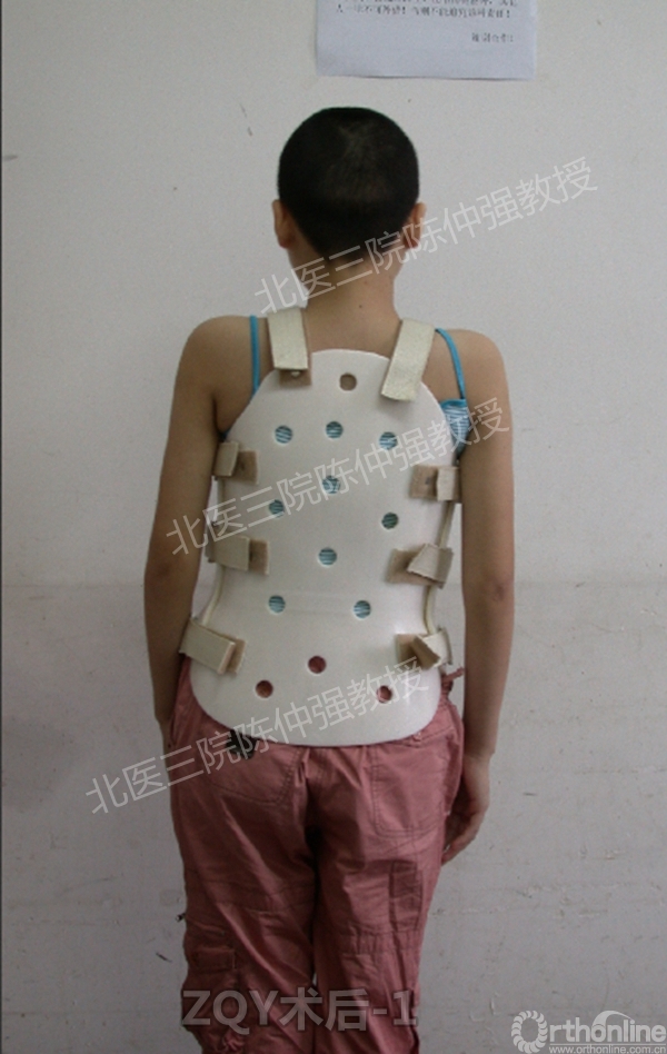 7ZQY术后-1.jpg