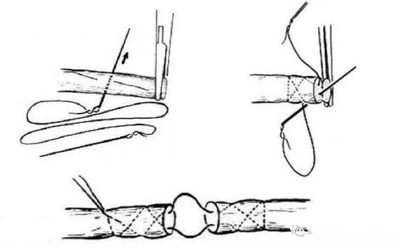 间断缝合法图解图片