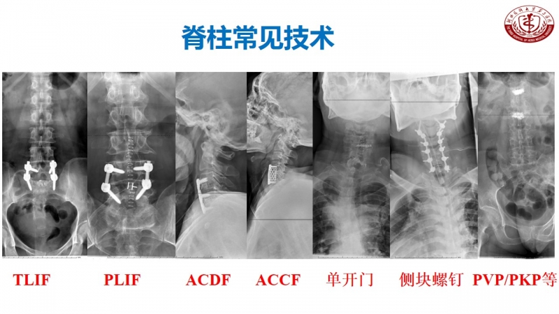 幻灯片14.JPG