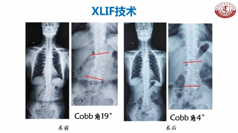 幻灯片22.JPG