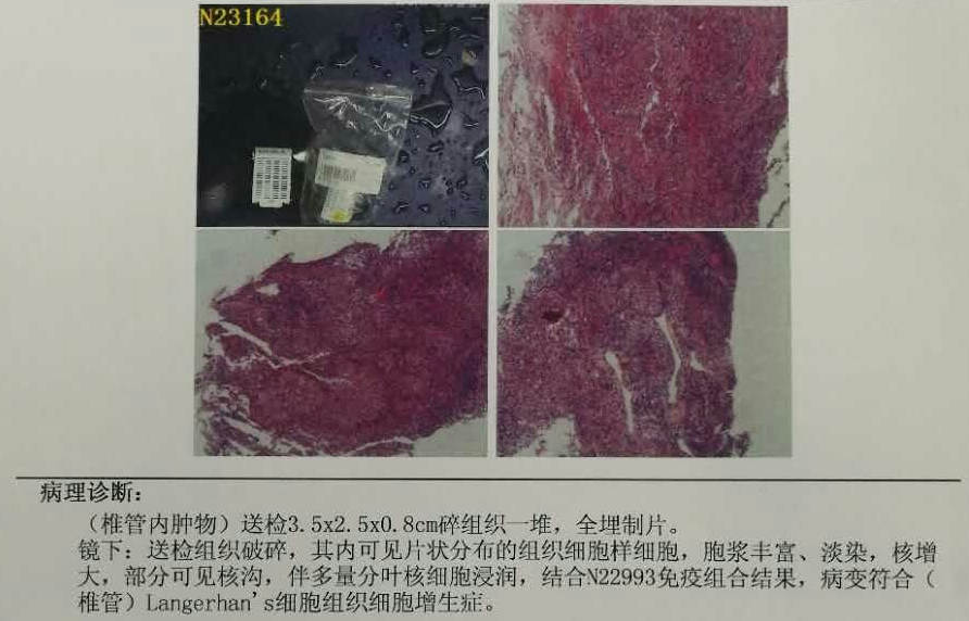 病理诊断.png