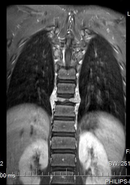 MRI-1.jpg