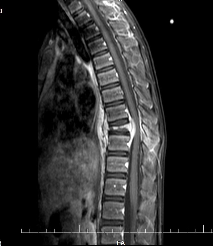 MRI-2.jpg