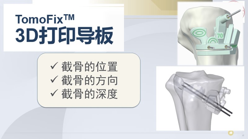 3d打印导板.jpg