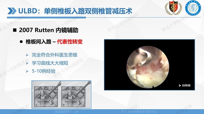 1. ULBD技术体系构建及临床应用 2023.4.5 - 15min_04.jpg