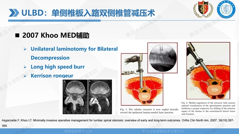 1. ULBD技术体系构建及临床应用 2023.4.5 - 15min_03.jpg