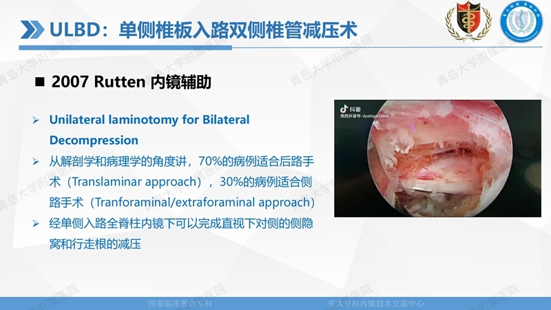 1. ULBD技术体系构建及临床应用 2023.4.5 - 15min_05.jpg