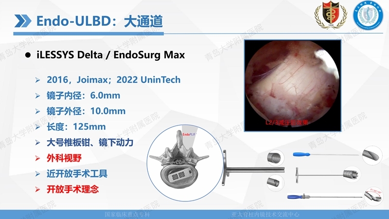 1. ULBD技术体系构建及临床应用 2023.4.5 - 15min_12.jpg