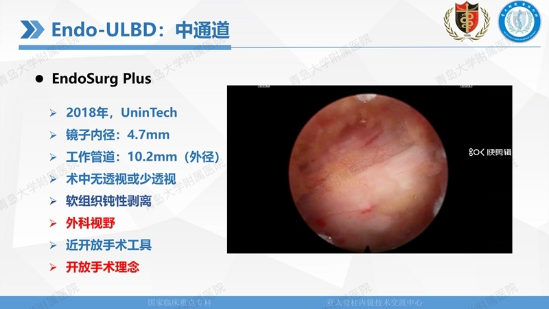 1. ULBD技术体系构建及临床应用 2023.4.5 - 15min_11.jpg