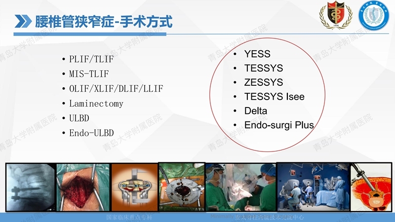 1. ULBD技术体系构建及临床应用 2023.4.5 - 15min_17.jpg