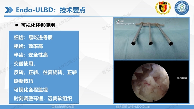 1. ULBD技术体系构建及临床应用 2023.4.5 - 15min_21.jpg