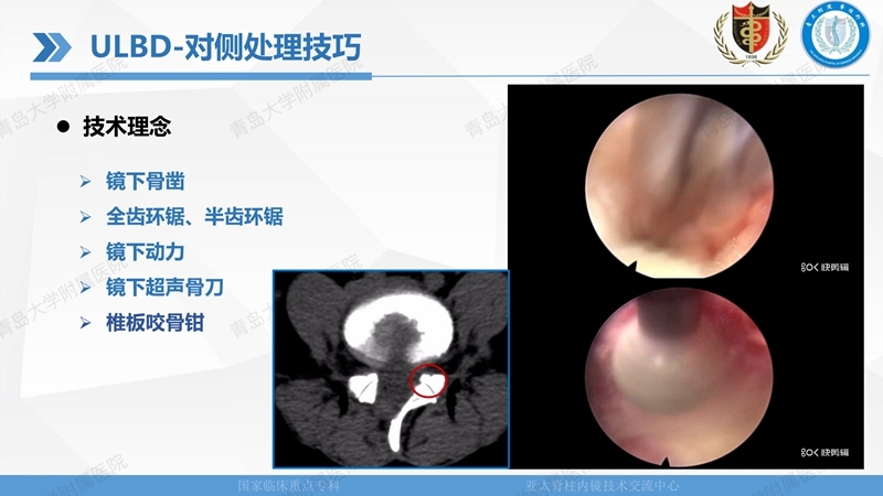 1. ULBD技术体系构建及临床应用 2023.4.5 - 15min_25.jpg