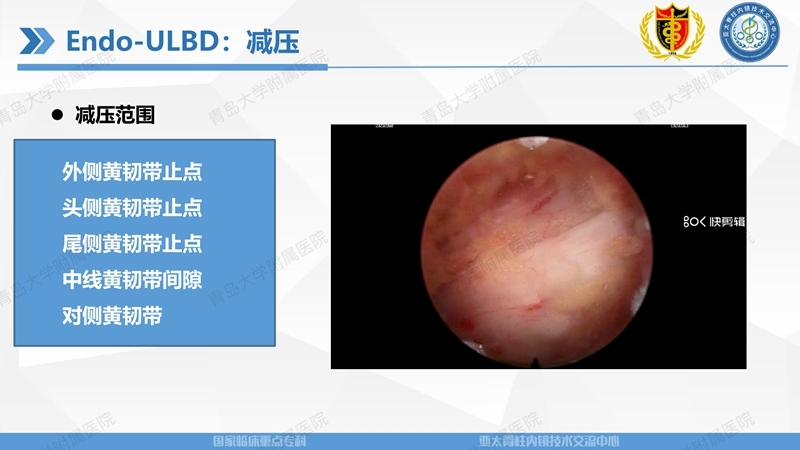 1. ULBD技术体系构建及临床应用 2023.4.5 - 15min_24.jpg