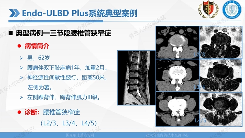 1. ULBD技术体系构建及临床应用 2023.4.5 - 15min_28.jpg