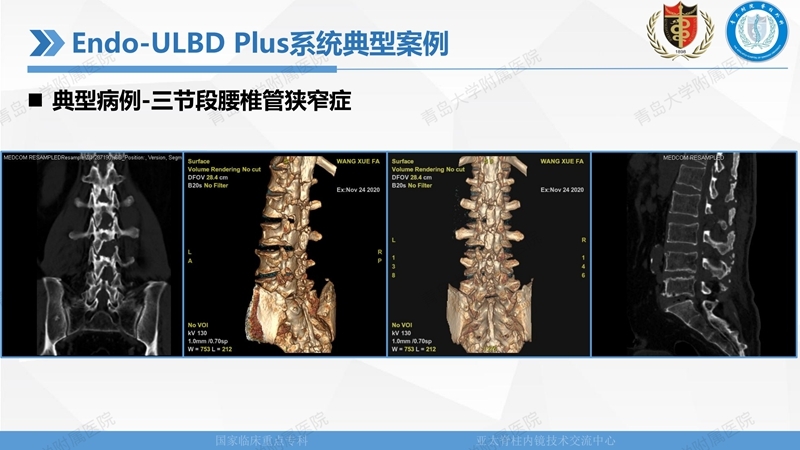 1. ULBD技术体系构建及临床应用 2023.4.5 - 15min_33.jpg
