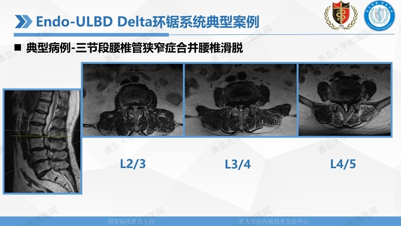 1. ULBD技术体系构建及临床应用 2023.4.5 - 15min_38.jpg