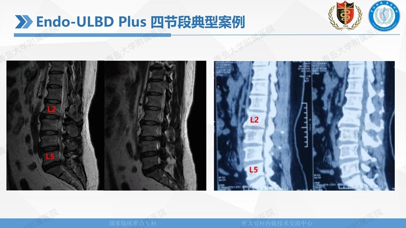 1. ULBD技术体系构建及临床应用 2023.4.5 - 15min_44.jpg
