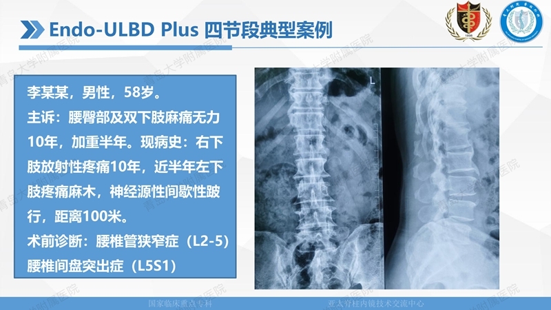 1. ULBD技术体系构建及临床应用 2023.4.5 - 15min_43.jpg