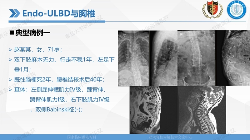 1. ULBD技术体系构建及临床应用 2023.4.5 - 15min_60.jpg