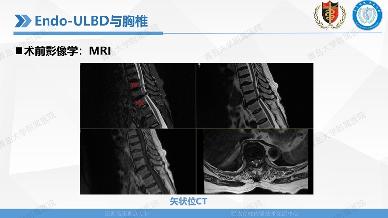1. ULBD技术体系构建及临床应用 2023.4.5 - 15min_65.jpg