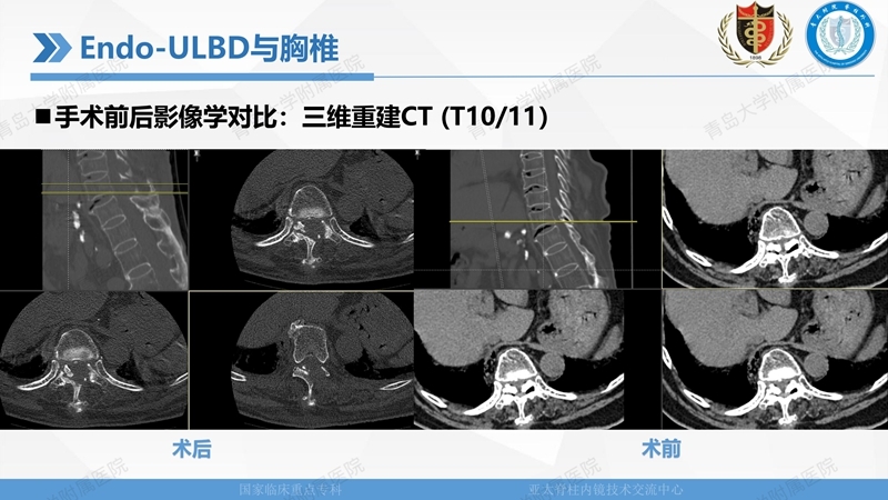1. ULBD技术体系构建及临床应用 2023.4.5 - 15min_75.jpg