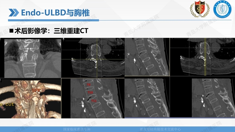 1. ULBD技术体系构建及临床应用 2023.4.5 - 15min_74.jpg