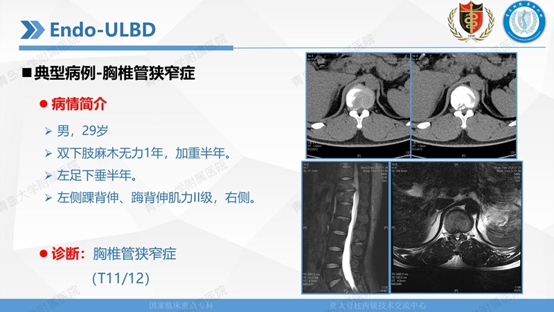 1. ULBD技术体系构建及临床应用 2023.4.5 - 15min_77.jpg