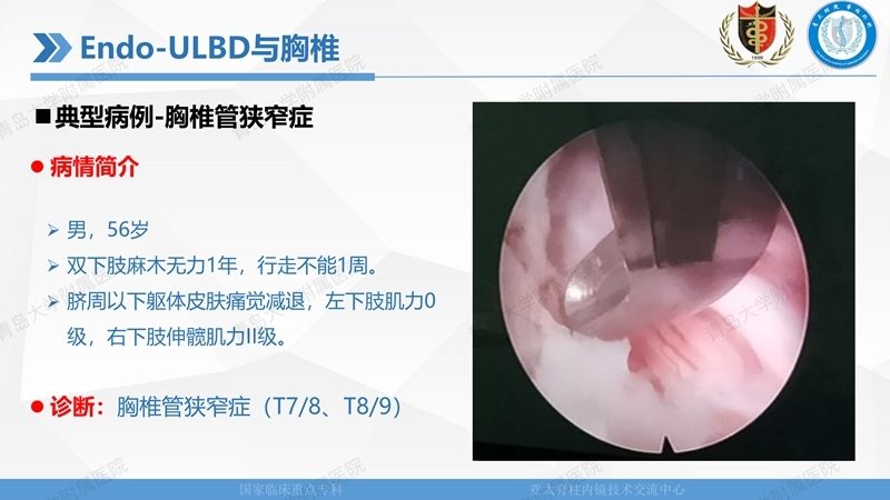 1. ULBD技术体系构建及临床应用 2023.4.5 - 15min_83.jpg