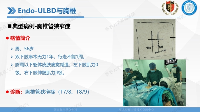 1. ULBD技术体系构建及临床应用 2023.4.5 - 15min_82.jpg