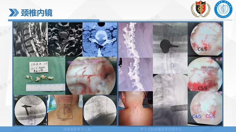 1. ULBD技术体系构建及临床应用 2023.4.5 - 15min_88.jpg