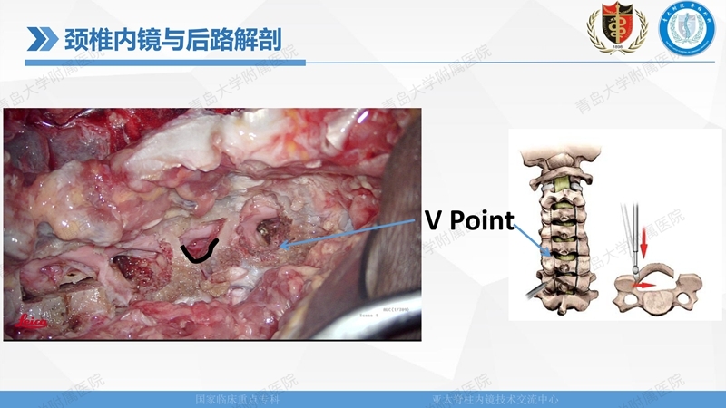 1. ULBD技术体系构建及临床应用 2023.4.5 - 15min_89.jpg