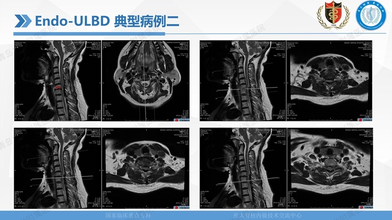 1. ULBD技术体系构建及临床应用 2023.4.5 - 15min_99.jpg