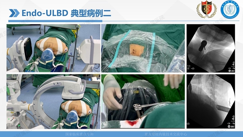 1. ULBD技术体系构建及临床应用 2023.4.5 - 15min_100.jpg