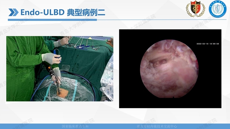 1. ULBD技术体系构建及临床应用 2023.4.5 - 15min_101.jpg