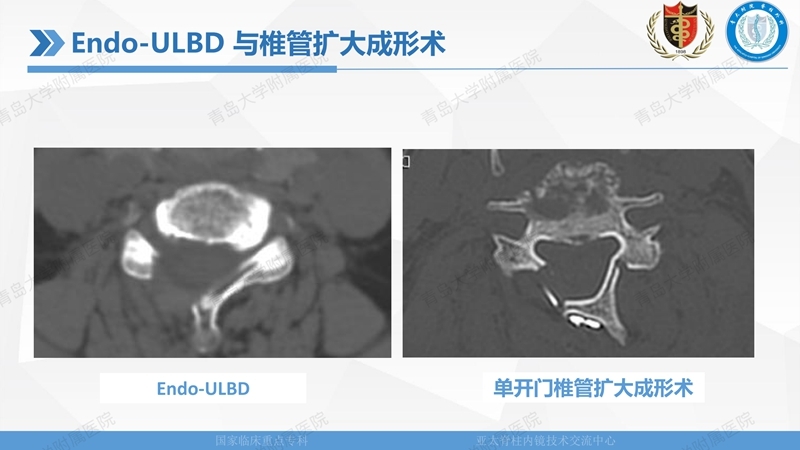 1. ULBD技术体系构建及临床应用 2023.4.5 - 15min_105.jpg