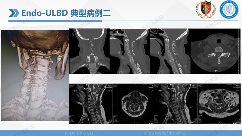 1. ULBD技术体系构建及临床应用 2023.4.5 - 15min_104.jpg