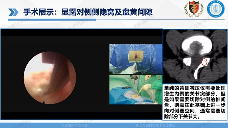 1. ULBD技术体系构建及临床应用 2023.4.5 - 15min_114.jpg
