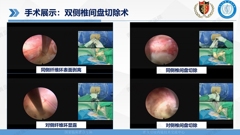 1. ULBD技术体系构建及临床应用 2023.4.5 - 15min_115.jpg